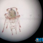 Variegated Sea Urchin Larvae