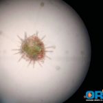 Newly metamorphosed Variegated Sea Urchin